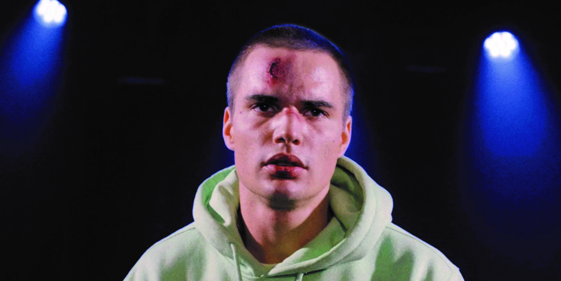 Close-up film still of a young man with fresh injuries on his nose and forehead with a determined expression. The background is stark black except for two spotlights on either side of him.